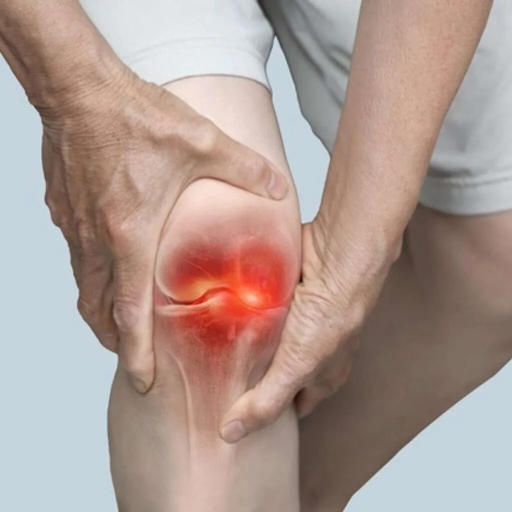 Arthritis & Joint Pain
